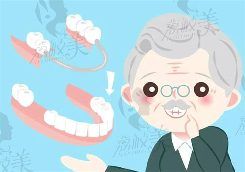 上海雅悦齿科老年人安装假牙的优势