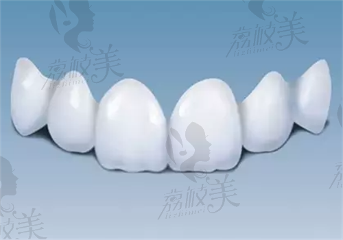 上海哪家牙科医院镶假牙好？