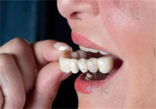 上海哪家牙科医院镶假牙好？