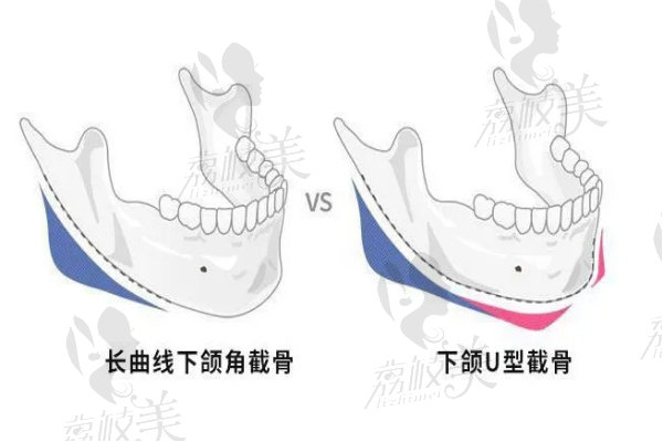 李志海磨骨线条流畅