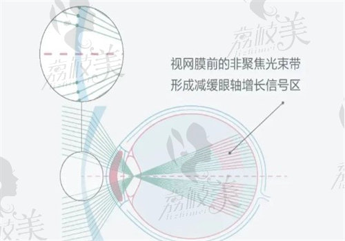 依视路星趣控镜片介绍