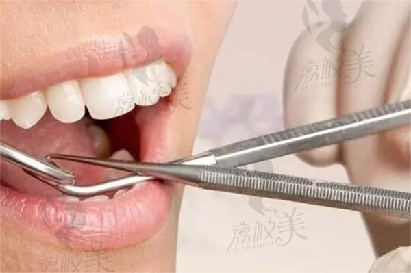上海哪个医院拔牙性价比高