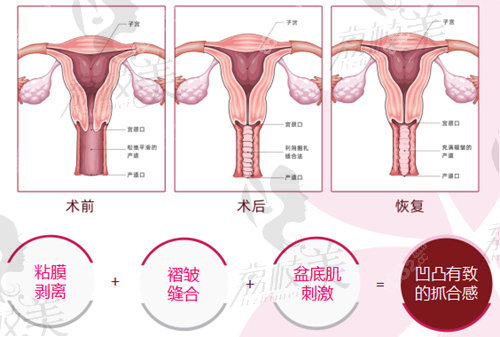 私密整形術(shù)前術(shù)后