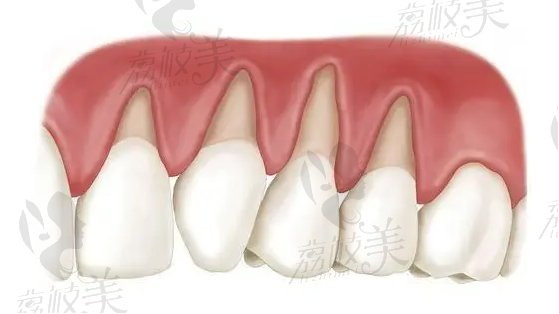 根管治療醫(yī)院