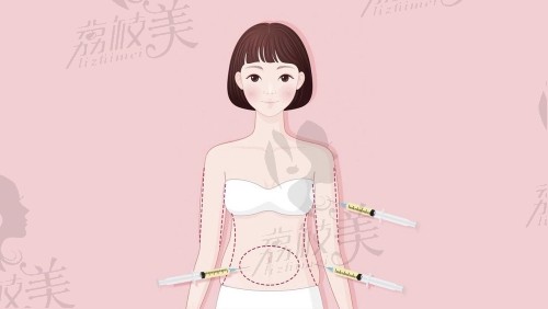 冯斌抽脂和普通抽脂的区别 冯斌抽脂和普通抽脂的区别