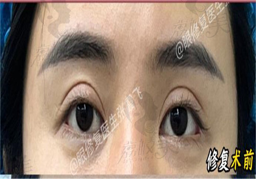 張霞飛修復(fù)眼睛技術(shù)好