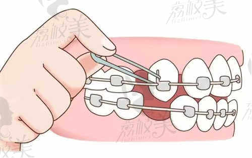 深圳诺德口腔医院