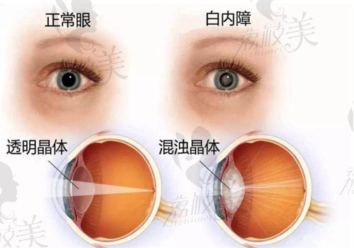 眼科医生段欣荣怎么样