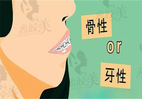 广大薛国初歪脸手术价格：4万-12万元起