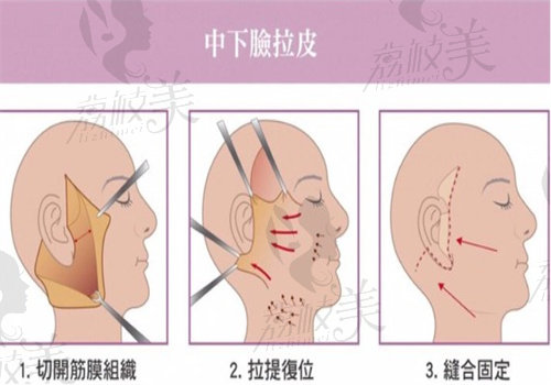 王冀耕技术如何？