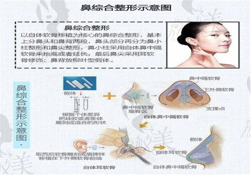 成都黄开亮医生怎么样？