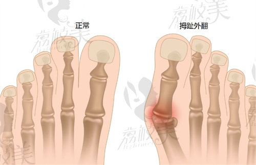 上海虹桥医院李茂盛怎么样