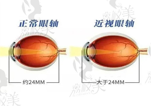 后巩膜加固术医生排名介绍