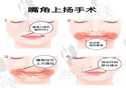 韩国Avant李炫直嘴角上扬