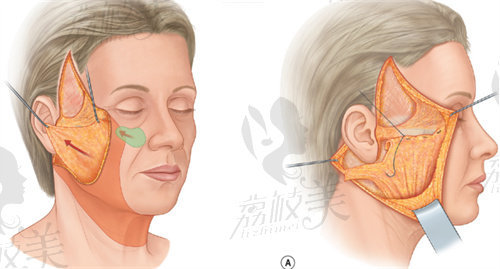 深圳文豐醫(yī)生口碑怎么樣？