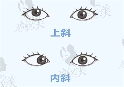 成都爱尔眼科林江医生预约挂号