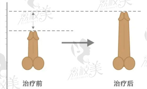 重庆星荣整形外科医院做男科私密整形怎么样？