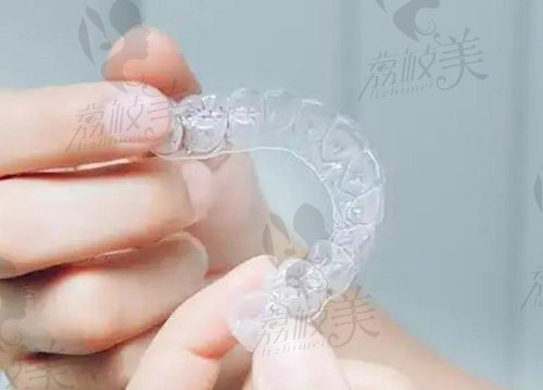 隐形矫正图片