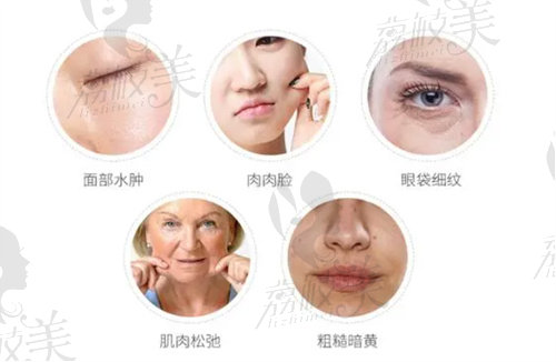 电波拉皮维持几年