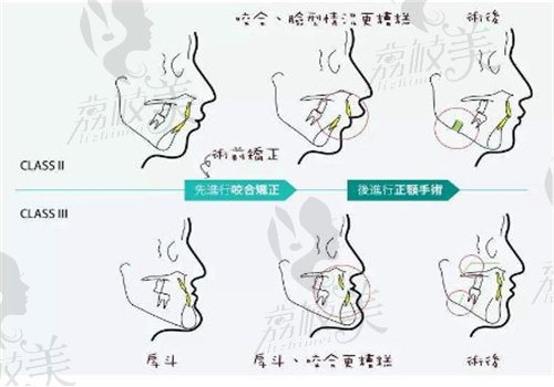 重庆王涛正颌怎么样？ 