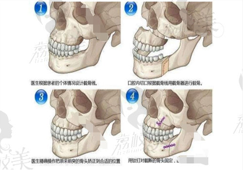 重庆王涛正颌怎么样？ 