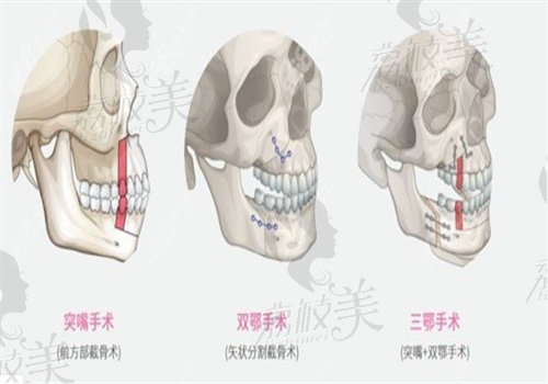 重慶王濤正頜怎么樣？ 