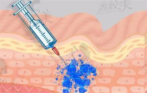 温州艺星微整注射技术好的医生名单