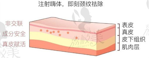 嗨体去颈纹1.5和2.5那个打细纹比较好？