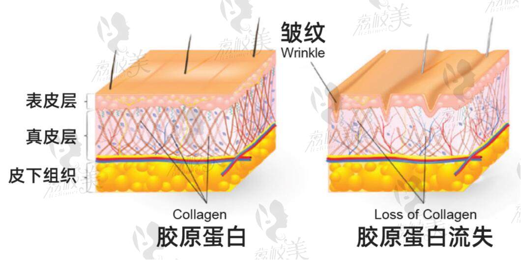 再生骨胶原是什么成分