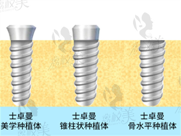 瑞士士卓曼种植体有几种档次