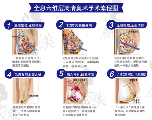 上海取奥美定哪个医院好