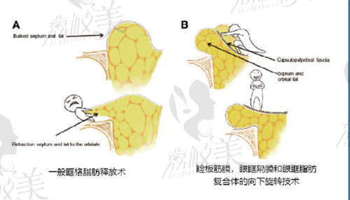 天津君珏诺颜医疗美容医院黄震英医生怎么样