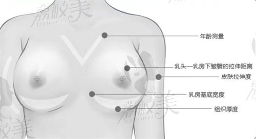 武汉五洲葛海辉曼托假体隆胸怎么样