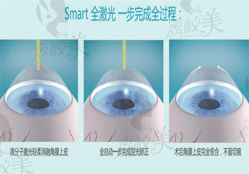 acf204108d0b1955859cd4d841414ed.png