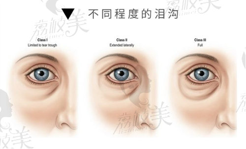 南京美萊易朝華院長怎么樣