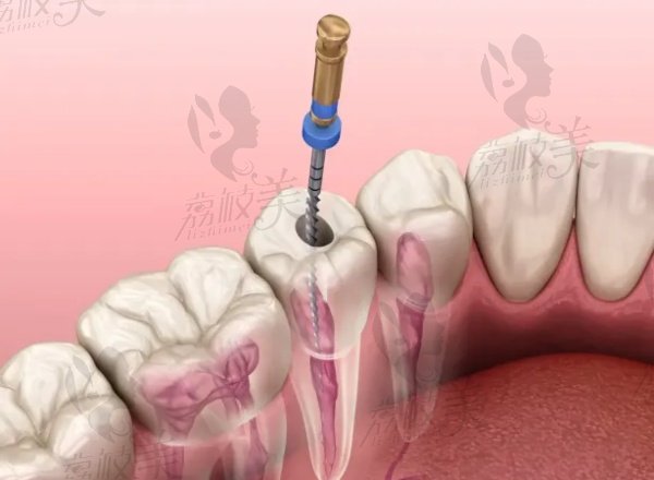 秦皇岛麦格口腔其他牙科价格表