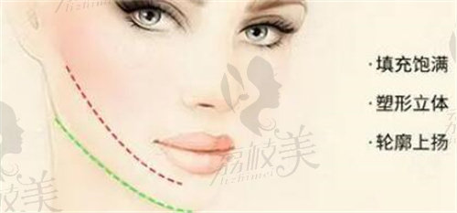 乌鲁木齐王共礼整形做脂肪填充怎么样？
