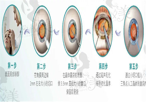 贵港华厦眼科医院技术微创