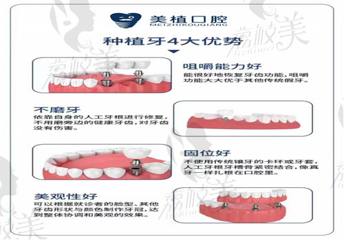 哈爾濱美植口腔醫(yī)院種植牙優(yōu)勢(shì)