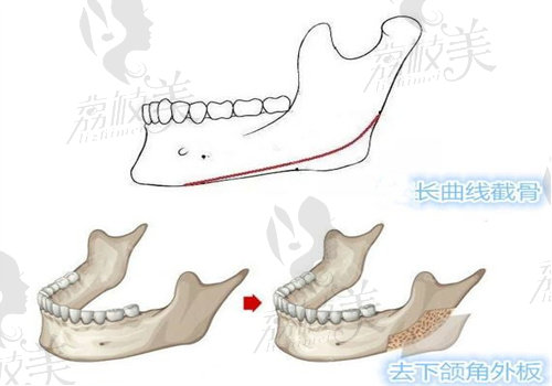 羅恩醫(yī)生輪廓怎么樣