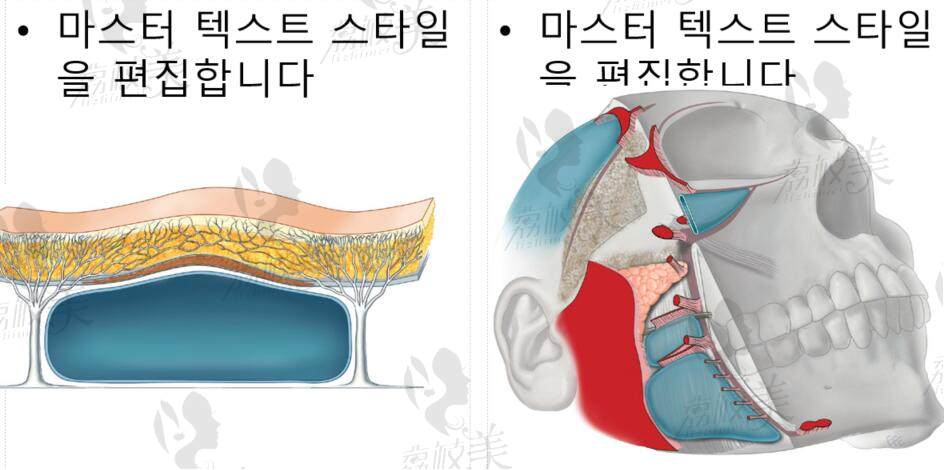 V美减龄之v6手术靠谱吗