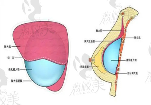 合肥劉冷隆胸醫(yī)生簡介