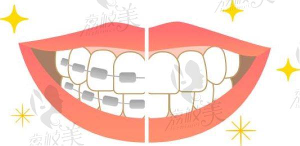 洛阳牙大夫口腔牙齿矫正多少钱