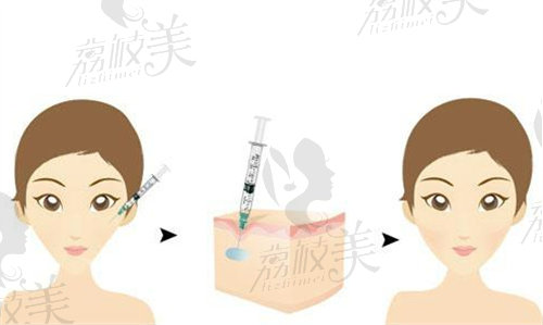 韩国pilloseu皮肤科怎么样 韩国pilloseu皮肤科怎么样