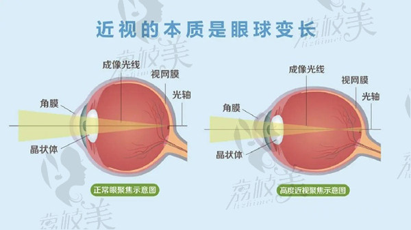 北京熙仁眼科醫(yī)院王樂今醫(yī)生