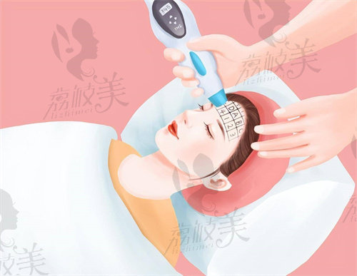 面部提升可以做哪些项目?