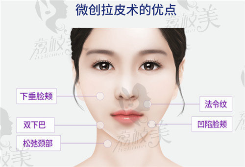 面部提升哪个成效好？