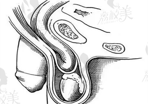 深圳八大处整形男性私密价目表