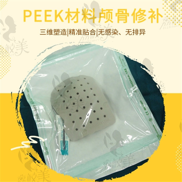 peek顱骨材料2024價(jià)格表