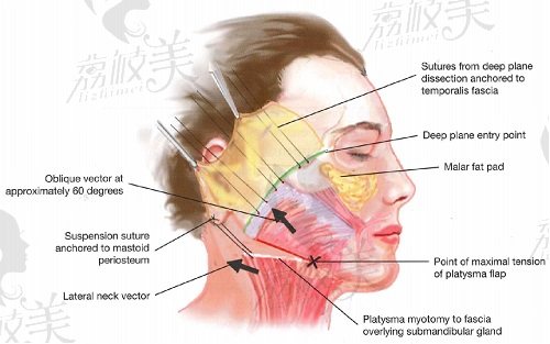 北京加减美v美减龄术可以维持多长时间？